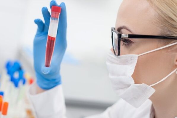 esame del sangue per ipertensione